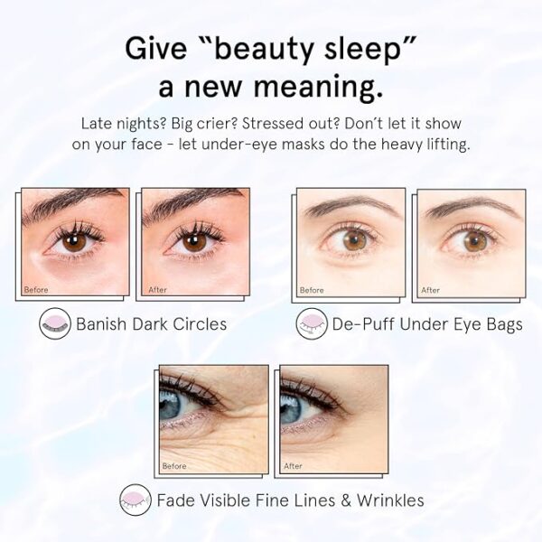 grace & stella Under Eye Patches for Puffy Eyes and Dark Circles (Retinol, 24 Pairs) Restoring Gel Under Eye Masks with Hyaluronic Acid – Vegan Cruelty-Free Skincare Birthday Gifts for Women - Image 3